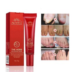 15g Nail Repair Cream Toenail Fungus Treatment Exfoliating Dead Skin Sterilization Nail Cream