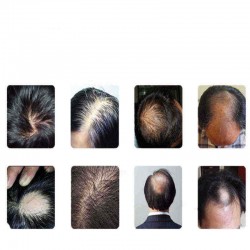 20ml Fast Hair Growth Nourishing Essence Hair Loss Treatment Serum Oil