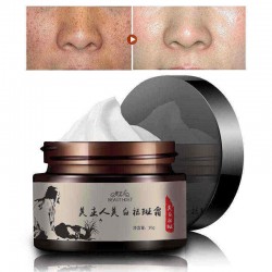 30g Freckle Cream Remove Sunburn Freckles Facial Cream Face Care