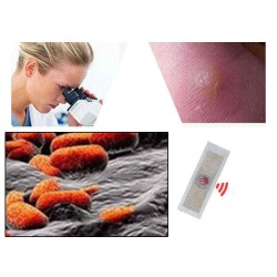 42Pcs Foot Corn Removal Plaster Anti Pruritus Anti Bacterial Foot Cleaning Health Non Woven Fabric