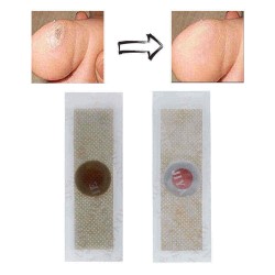 42Pcs Foot Corn Removal Plaster Anti Pruritus Anti Bacterial Foot Cleaning Health Non Woven Fabric