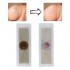 42Pcs Foot Corn Removal Plaster Anti Pruritus Anti Bacterial Foot Cleaning Health Non Woven Fabric