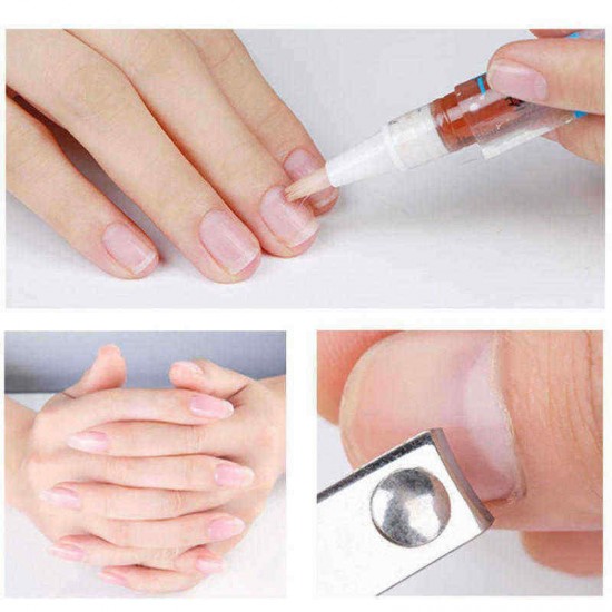 4Pcs Biological Toenail Fungus Stop Pencil Anti Fungal Nail Treatment Toenails Fingernail 4Pcs Biological Toenail Fungus Stop Pencil Anti Fungal Nail Treatment Toenails Fingernail