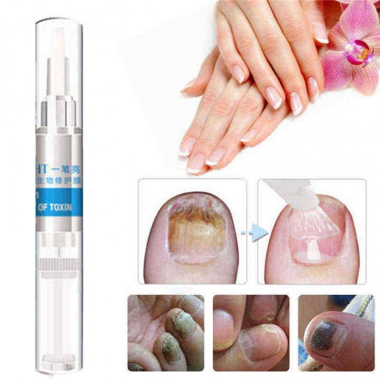 4Pcs Biological Toenail Fungus Stop Pencil Anti Fungal Nail Treatment Toenails Fingernail 4Pcs Biological Toenail Fungus Stop Pencil Anti Fungal Nail Treatment Toenails Fingernail