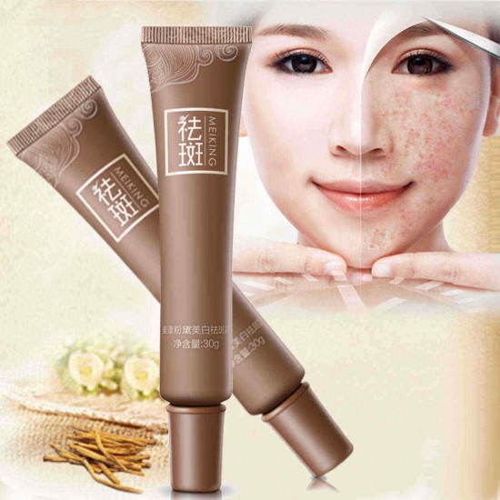 Age Spot Melasma Remove Freckle Face Cream Whitening Lightening Skin Care Age Spot Melasma Remove Freckle Face Cream Whitening Lightening Skin Care