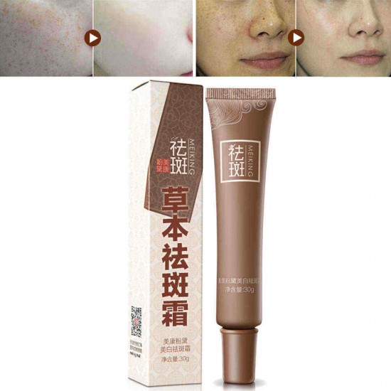 Age Spot Melasma Remove Freckle Face Cream Whitening Lightening Skin Care Age Spot Melasma Remove Freckle Face Cream Whitening Lightening Skin Care