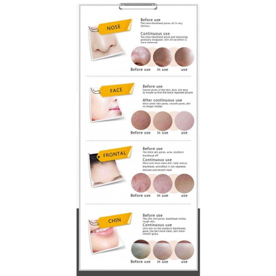 BIOAQUA Black Mask Blackhead  Acne Treatment Peel Off Face Masks