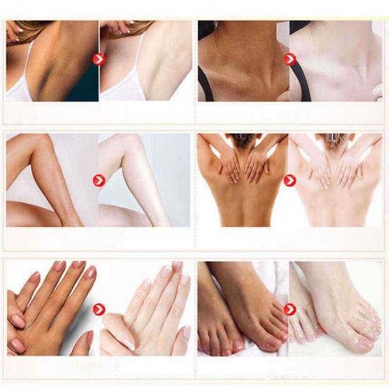 Body Creams Underarm Repair Cream Between Legs Knees Private Part 50g Body Creams Underarm Repair Cream Between Legs Knees Private Part 50g