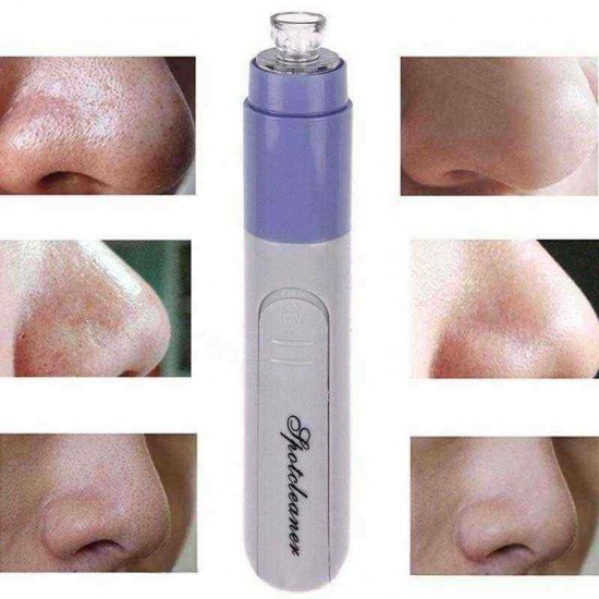 Electric Facial Pore Suction Spot Cleaner Blackhead Remover Acne Pimple Cleanser Lifting Firming Skin Electric Facial Pore Suction Spot Cleaner Blackhead Remover Acne Pimple Cleanser Lifting Firming Skin