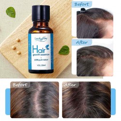 Hair Growth Essence Oil Anti Hair Loss Nutrition Hair Root Inmprove Hair Thick Shiny Hair Care 20ml