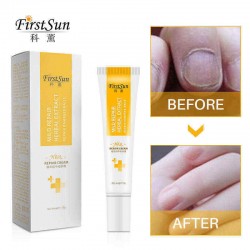 Ke Xunzhi Extract Nail Repair Cream Moisturizer Cream