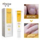 Ke Xunzhi Extract Nail Repair Cream Moisturizer Cream