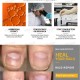 Ke Xunzhi Extract Nail Repair Cream Moisturizer Cream