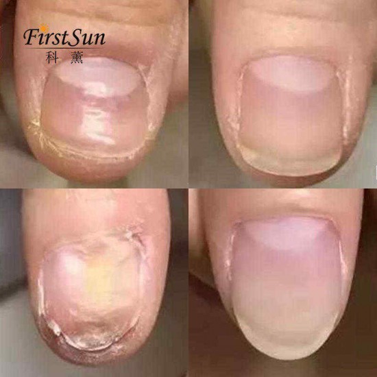 Ke Xunzhi Extract Nail Repair Cream Moisturizer Cream