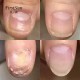 Ke Xunzhi Extract Nail Repair Cream Moisturizer Cream