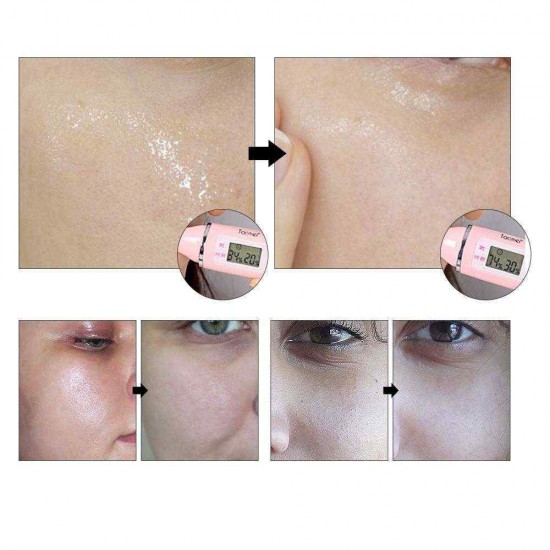 LANBENA Hyaluronic Acid Serum Snail Essence Moisturizing Acne Treatment Repair Anti-Aning Winkles LANBENA Hyaluronic Acid Serum Snail Essence Moisturizing Acne Treatment Repair Anti-Aning Winkles