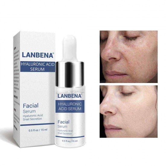 LANBENA Hyaluronic Acid Serum Snail Essence Moisturizing Acne Treatment Repair Anti-Aning Winkles LANBENA Hyaluronic Acid Serum Snail Essence Moisturizing Acne Treatment Repair Anti-Aning Winkles