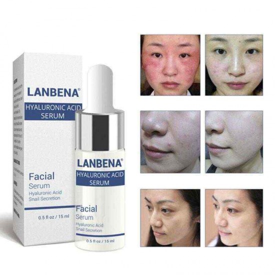 LANBENA Hyaluronic Acid Serum Snail Essence Moisturizing Acne Treatment Repair Anti-Aning Winkles LANBENA Hyaluronic Acid Serum Snail Essence Moisturizing Acne Treatment Repair Anti-Aning Winkles