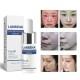 LANBENA Hyaluronic Acid Serum Snail Essence Moisturizing Acne Treatment Repair Anti-Aning Winkles LANBENA Hyaluronic Acid Serum Snail Essence Moisturizing Acne Treatment Repair Anti-Aning Winkles