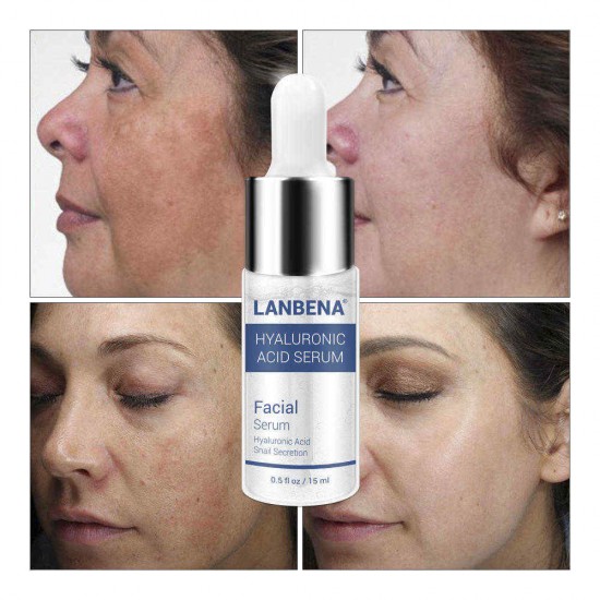 LANBENA Hyaluronic Acid Serum Snail Essence Moisturizing Acne Treatment Repair Anti-Aning Winkles LANBENA Hyaluronic Acid Serum Snail Essence Moisturizing Acne Treatment Repair Anti-Aning Winkles