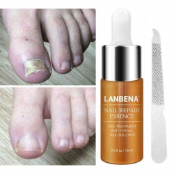 LANBENA Nail Repair Essence Nail File Set Nail Treatment Liquid Nail File Brighten Nail Nail Care Liquid Essence