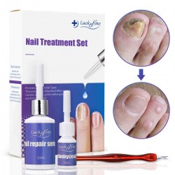 LuckyFine Toenail Fungus Treatment Set Onychomycosis Gel Nail Repair Serum Nail Care Tool