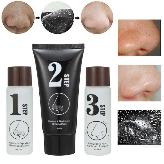 Luckyfine 3 Steps Blackhead Removal Face Nose Mask Blackhead Acne Removal Activated Carbon Set Luckyfine 3 Steps Blackhead Removal Face Nose Mask Blackhead Acne Removal Activated Carbon Set
