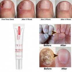 Nail Art Softener Soften Dead Skin Cuticle Remover Cream Manicure Tools Nail Treatment Cream