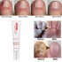 Nail Art Softener Soften Dead Skin Cuticle Remover Cream Manicure Tools Nail Treatment Cream