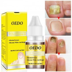 OEDM Nail Treatment Onychomycosis Paronychia Anti Fungal Nail Infection Toe Nail Fungus Treatment
