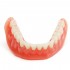 Precision Implants Restoration Teeth Demo Model Dental Overdenture Emulational