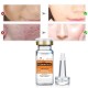 Pure 100% Vitamin C Serum Anti Aging Wrinkle Freckle Remove Face Lift Essence Pure 100% Vitamin C Serum Anti Aging Wrinkle Freckle Remove Face Lift Essence