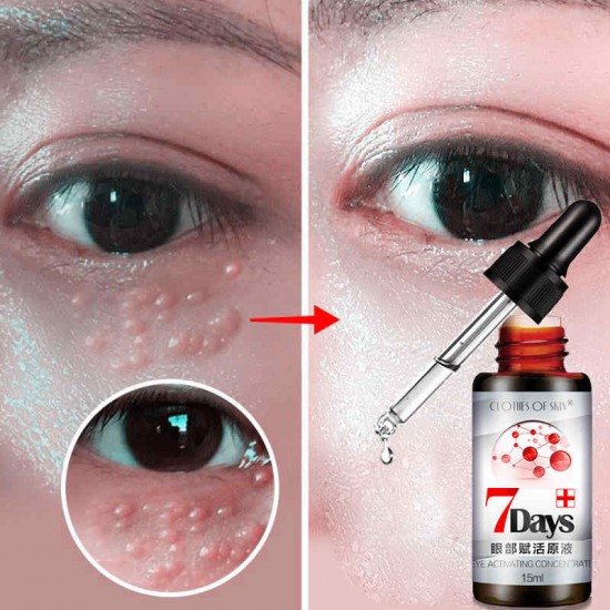 Revitalizing Eye Essence Liquid Fade Dark Circle Eye Bag Remove Fat Granule Essence Face Revitalizing Eye Essence Liquid Fade Dark Circle Eye Bag Remove Fat Granule Essence Face
