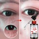Revitalizing Eye Essence Liquid Fade Dark Circle Eye Bag Remove Fat Granule Essence Face Revitalizing Eye Essence Liquid Fade Dark Circle Eye Bag Remove Fat Granule Essence Face