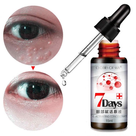 Revitalizing Eye Essence Liquid Fade Dark Circle Eye Bag Remove Fat Granule Essence Face Revitalizing Eye Essence Liquid Fade Dark Circle Eye Bag Remove Fat Granule Essence Face