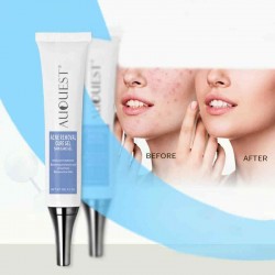 Scar Acne Marks Repair Cream Acne Blackhead Deep Cleaning Cream Facial Skin Care