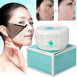 Suction Spot Cream Face Care Whitening Remove Freckle Dark Spots Scar Whitening Cream