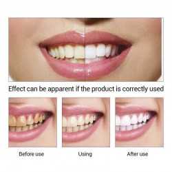 Teeth Whitening Cream Powder Oral Teeth Care Cleaning Remove Teeth Black Yellow Smoke Tea Stains