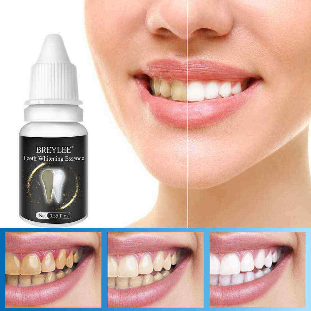 10-ml-Teeth-Whitening-Cream-Remove-Black-Tooth-Yellow-Tooth-Tooth-Tea-Stains-Teeth-Care-1332394