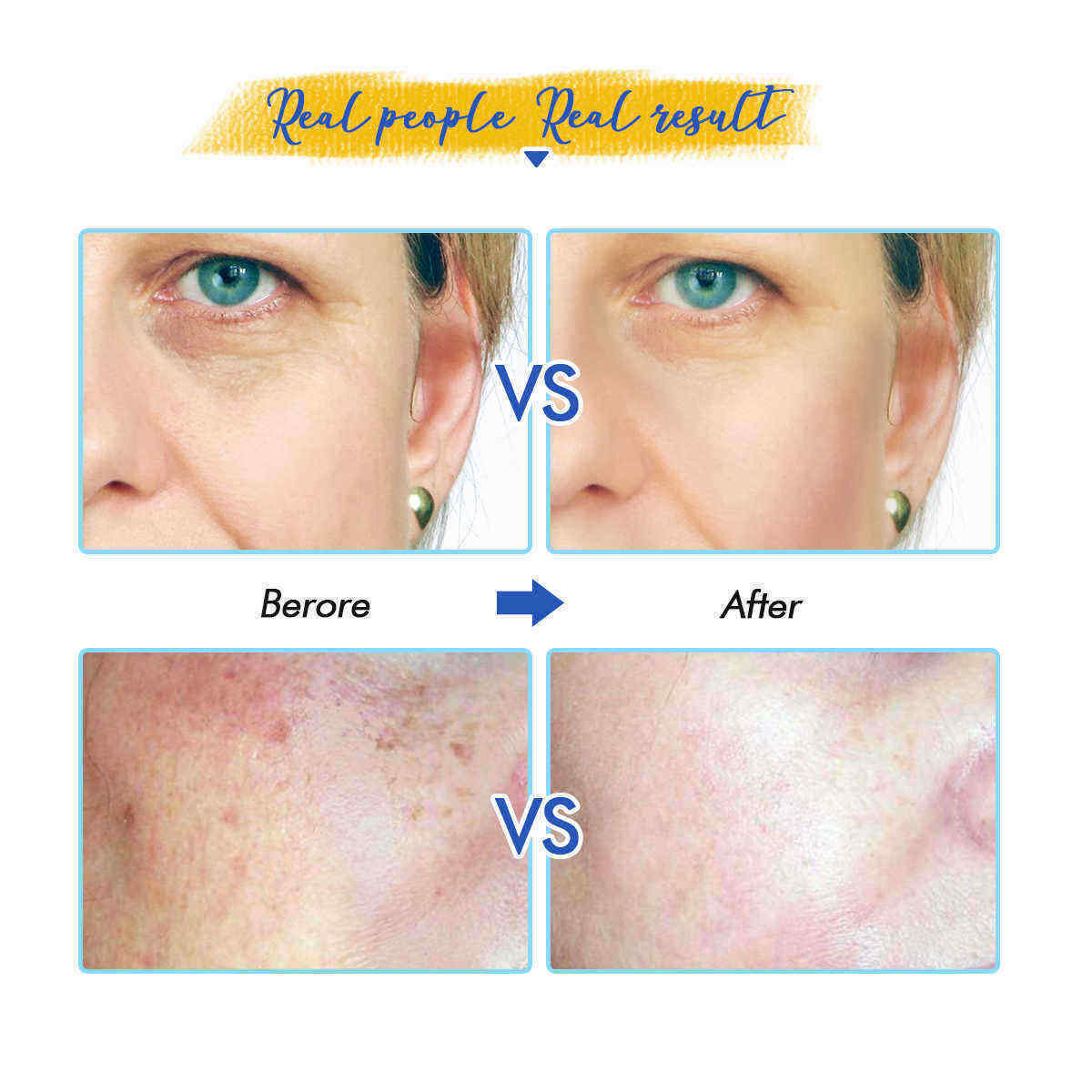 100ml-Hyaluronic-Acid-Serum-Skin-Repair-Essence-Anti-Aging-Wrinkle-Moisturizing-Serum-1442909