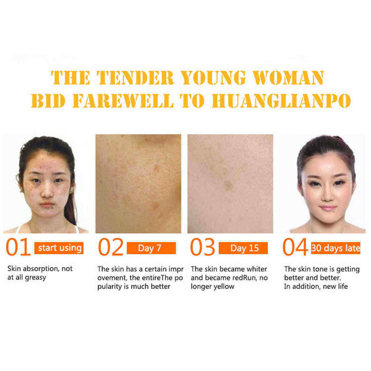 10ml-Anti-Dark-Spots-Vitamin-C-Oil-Ultra-Spotless-Essence-1349604