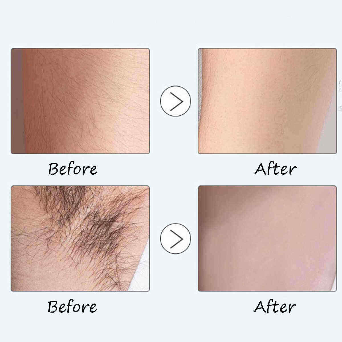10ml-Hair-Growth-Inhibitor-Essence-After-Hair-Removal-Cream-Repair-Liquid-Essence-Skin-Repairing-1442700