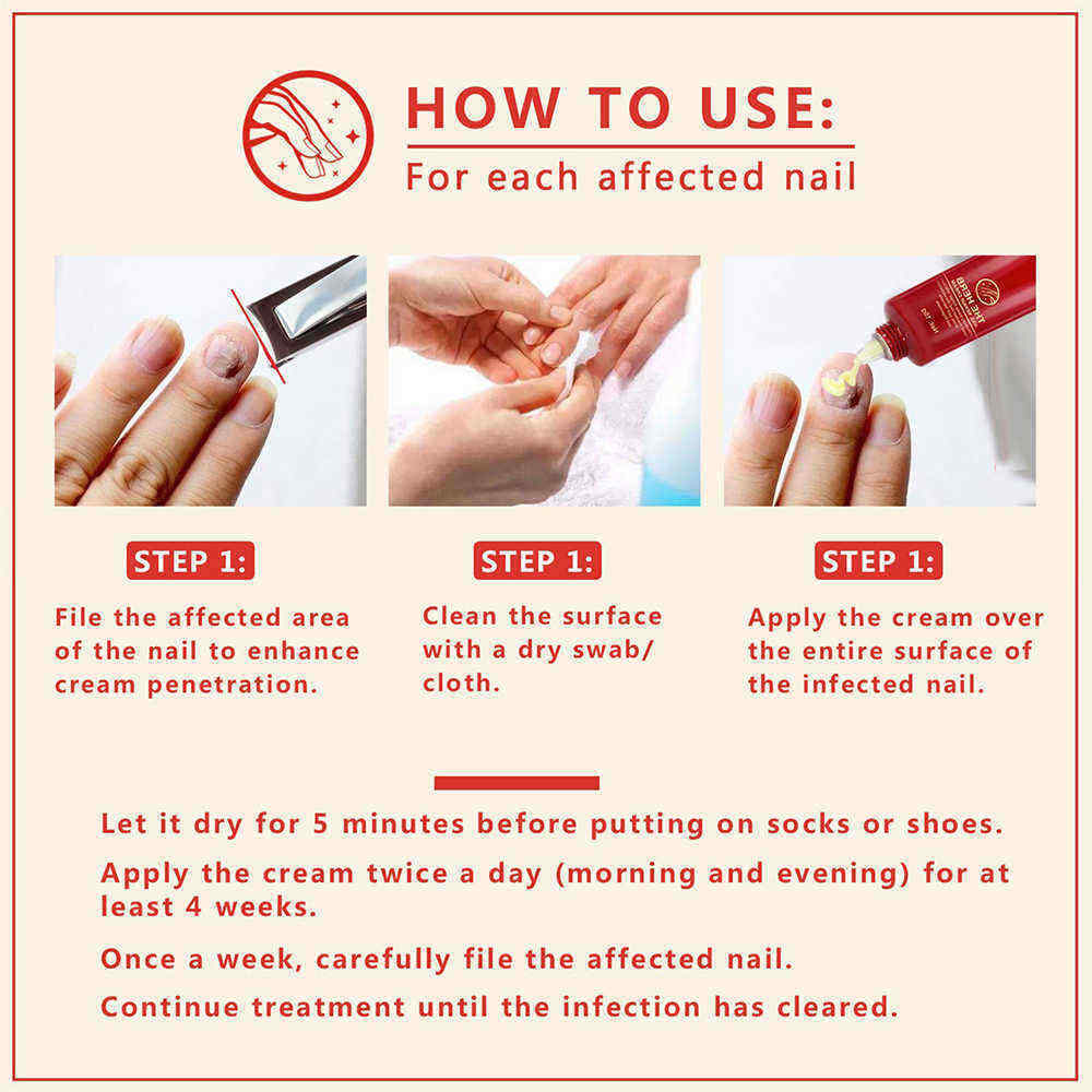 15g-Nail-Repair-Cream-Toenail-Fungus-Treatment-Exfoliating-Dead-Skin-Sterilization-Nail-Cream-1333530