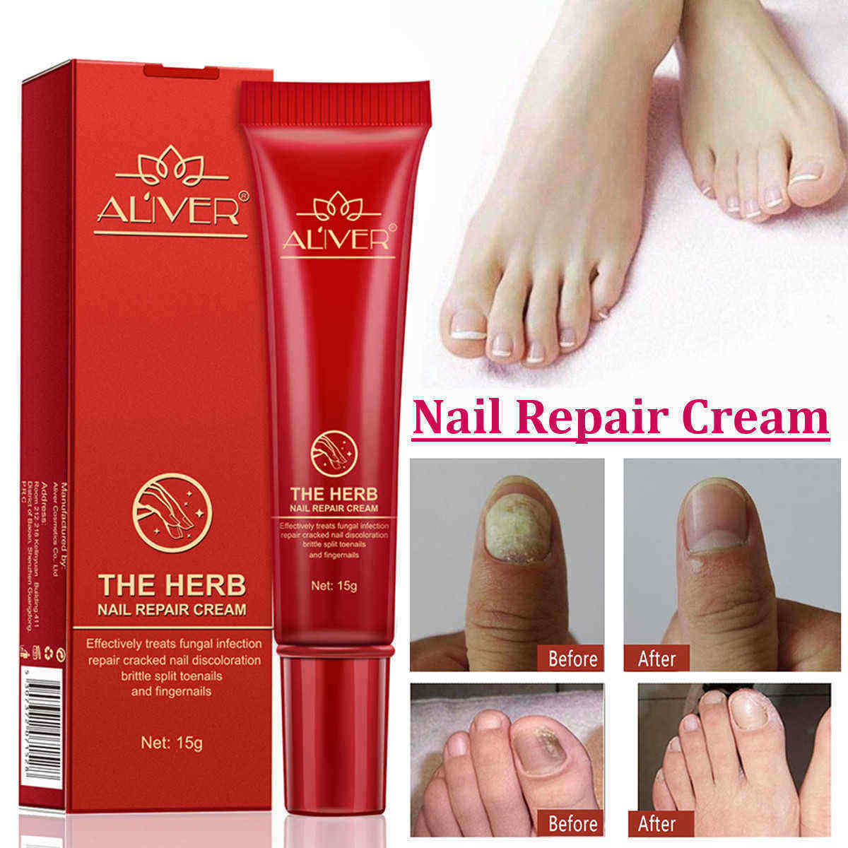 15g-Nail-Repair-Cream-Toenail-Fungus-Treatment-Exfoliating-Dead-Skin-Sterilization-Nail-Cream-1333530