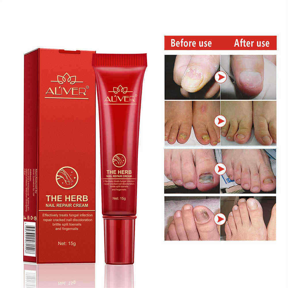 15g-Nail-Repair-Cream-Toenail-Fungus-Treatment-Exfoliating-Dead-Skin-Sterilization-Nail-Cream-1333530