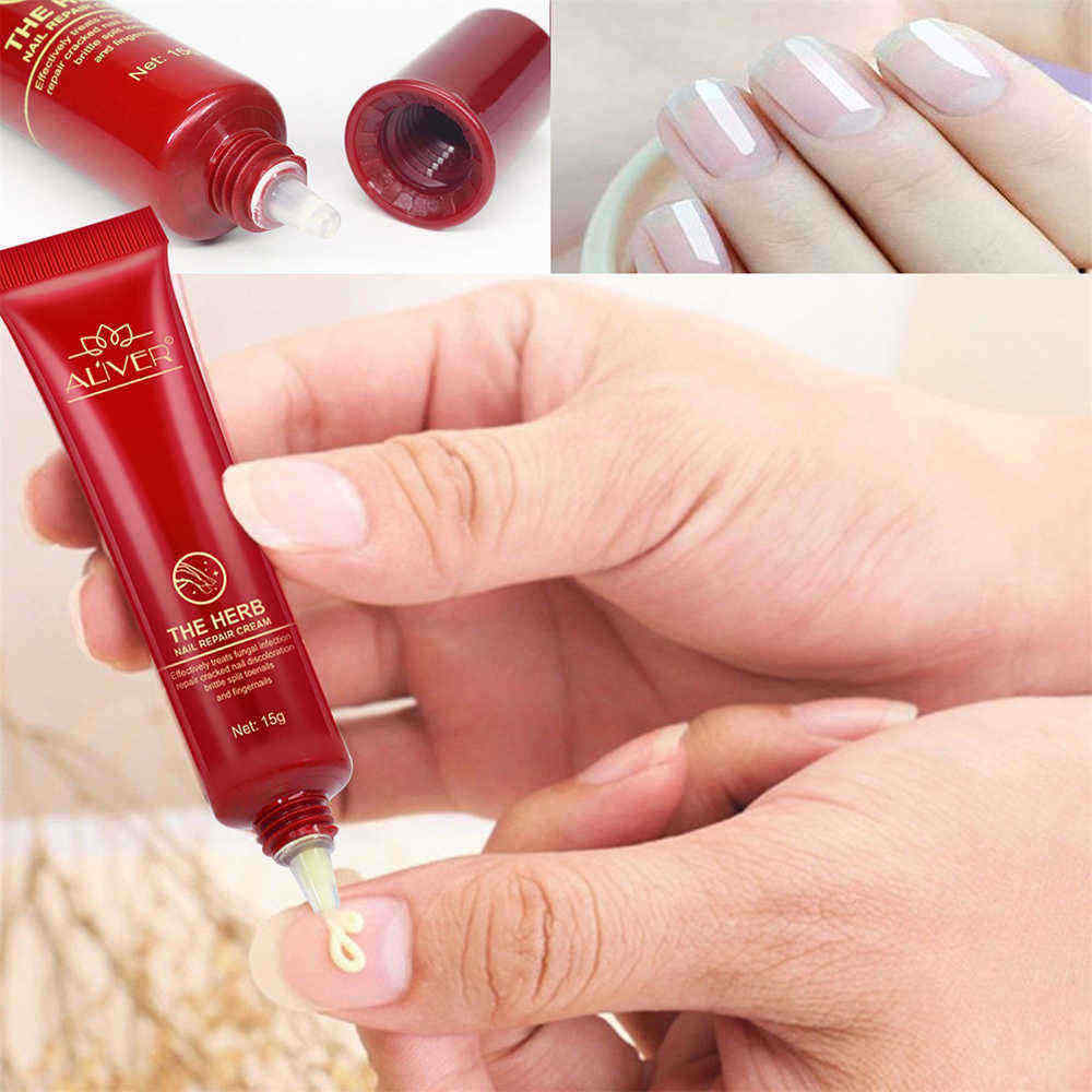15g-Nail-Repair-Cream-Toenail-Fungus-Treatment-Exfoliating-Dead-Skin-Sterilization-Nail-Cream-1333530