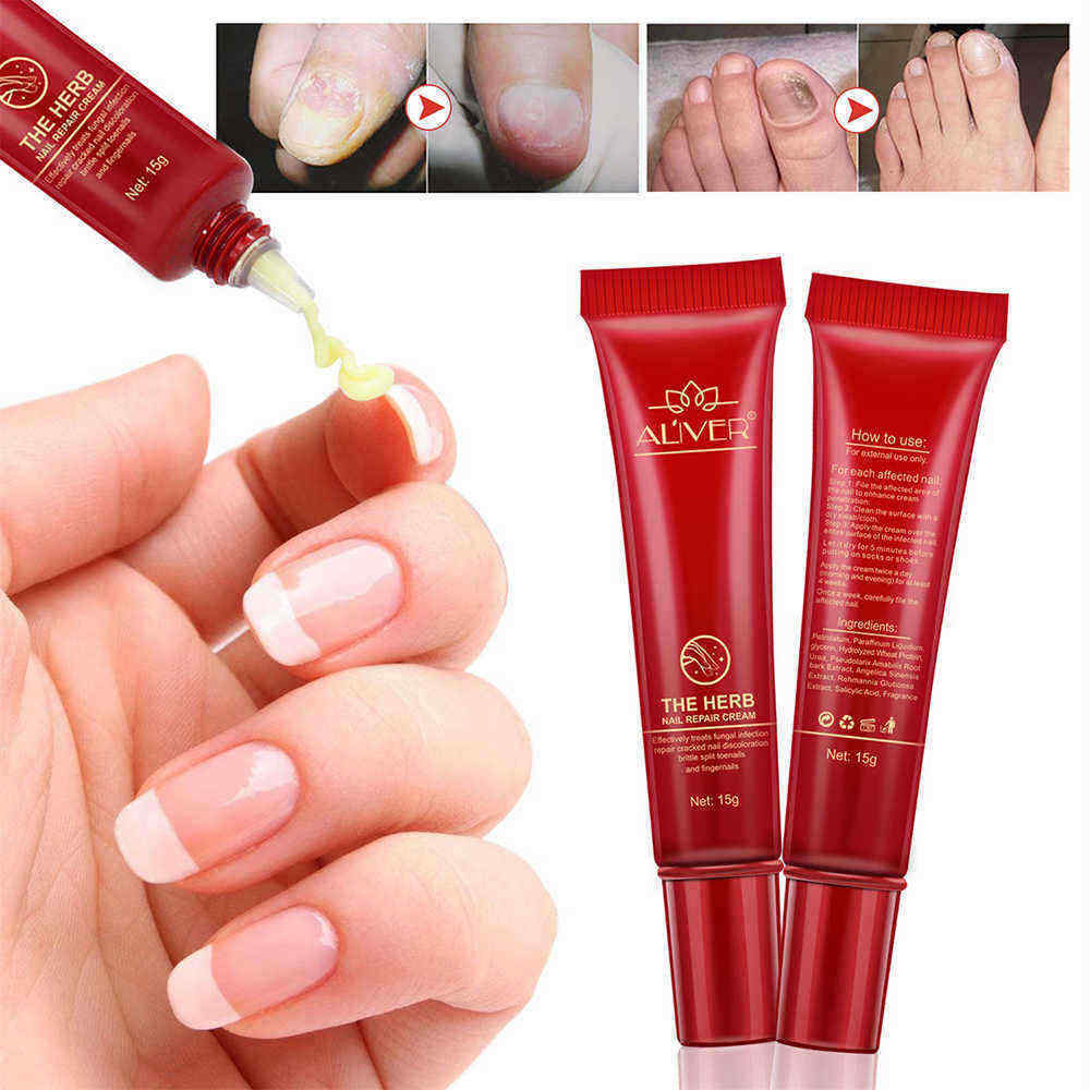 15g-Nail-Repair-Cream-Toenail-Fungus-Treatment-Exfoliating-Dead-Skin-Sterilization-Nail-Cream-1333530