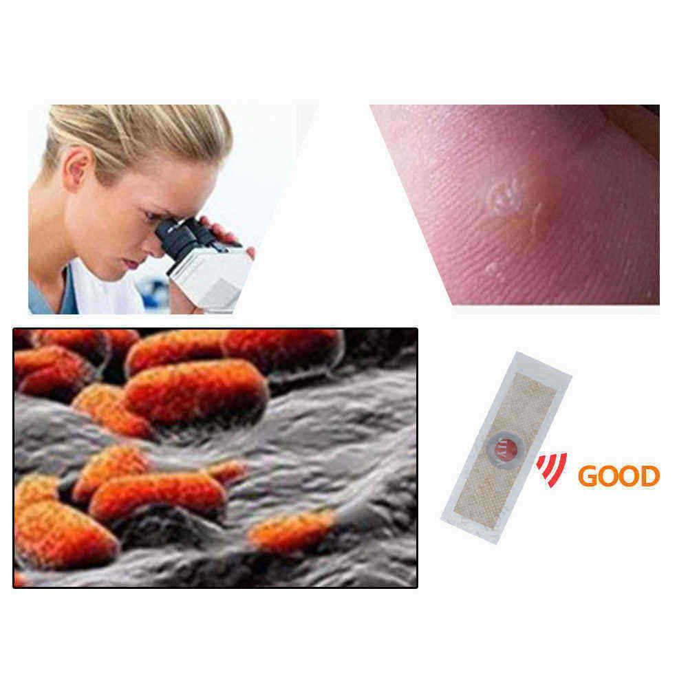 42Pcs-Foot-Corn-Removal-Plaster-Anti-Pruritus-Anti-Bacterial-Foot-Cleaning-Health-Non-Woven-Fabric-1314393