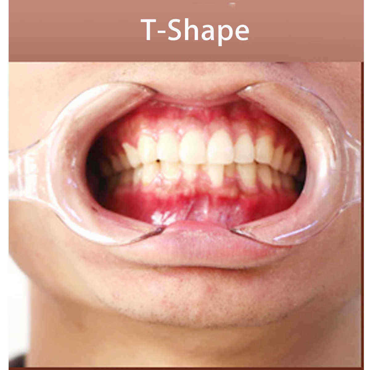 4Pcs-Dental-Double-headed-T-Shape-Intraoral-Cheek-Lip-Retractor-Mouth-Opener-1239047