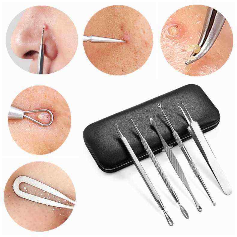 5Pcs-Blackhead-Acne-Blemish-Pimple-Remover-Extractor-Stainless-Steel-Tool-Kit-With-Mirror-Micro-Need-1144205